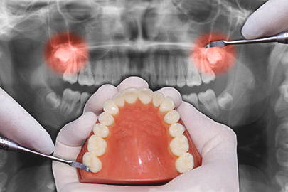 Cirugía oral Xàtiva