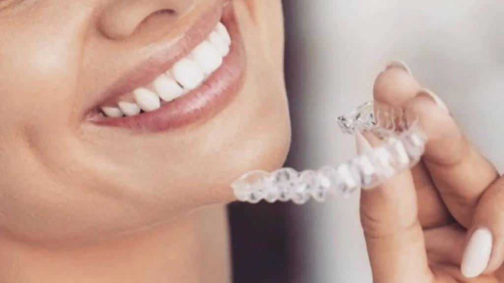 Ortodoncia invisible Invisalign